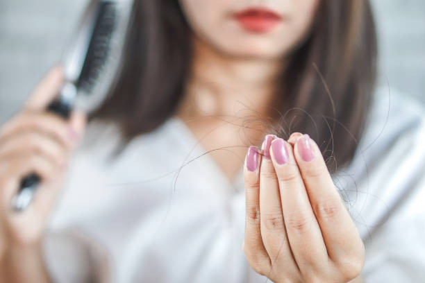 Atasi Rambut Rontok, Ini Produk Penumbuh Rambut Yang Bisa Kamu Coba