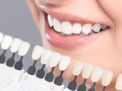 Ubah Jadi Putih Dan Bersih, Intip Cara Sederhana Mengatasi Gigi Kuning
