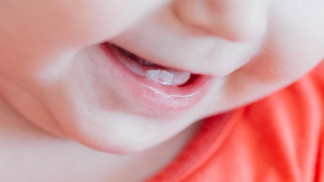 Jangan Panik Moms, Ini 7 Tanda Dan Gejala Tumbuh Gigi Pada Bayi