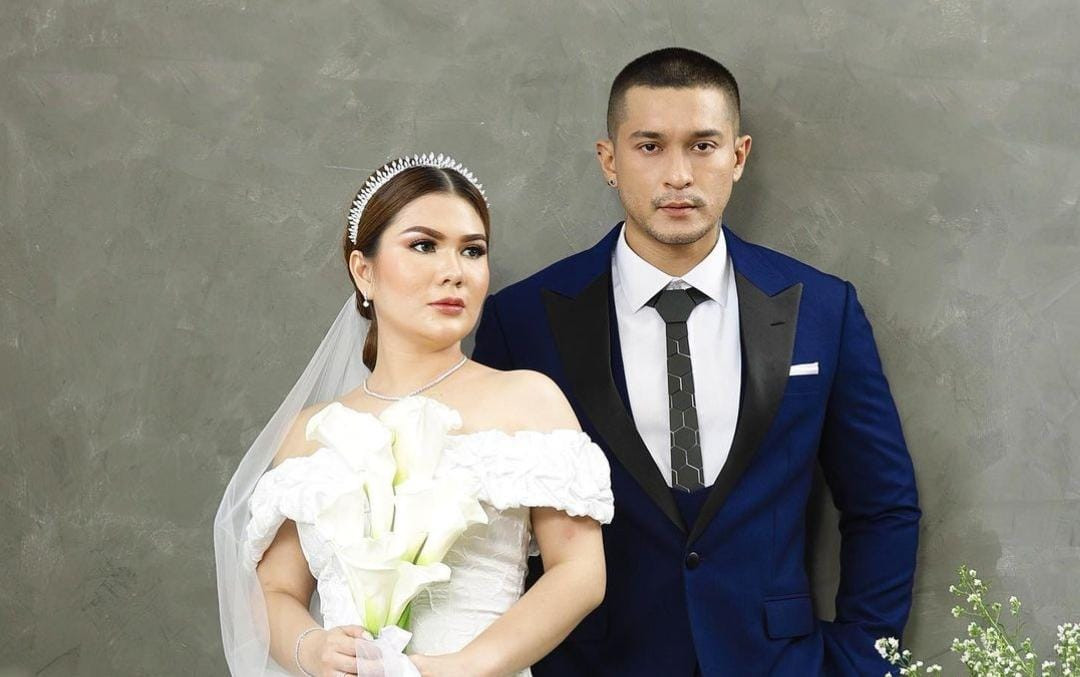 Mengidap Tumor Jinak di Telunjuk, Miller Khan: Ini Sudah Empat Tahun