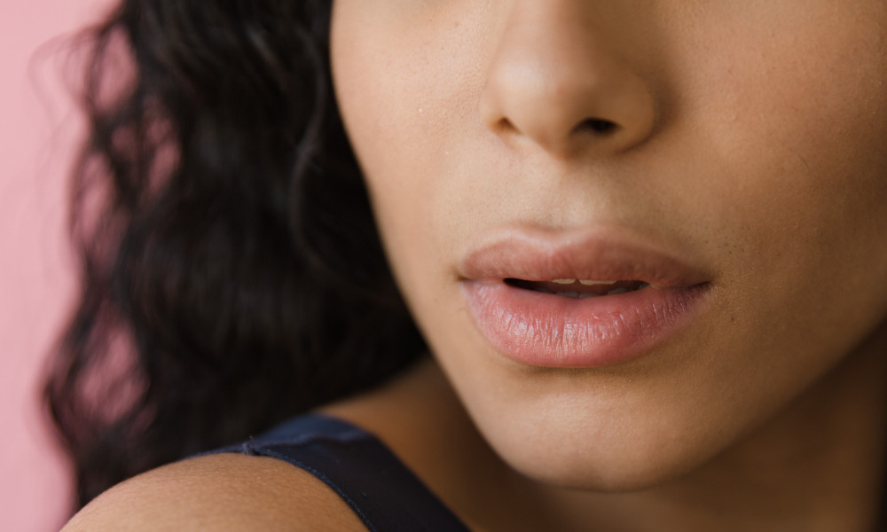 Cara Ampuh Mengatasi Bibir Kering Saat Puasa