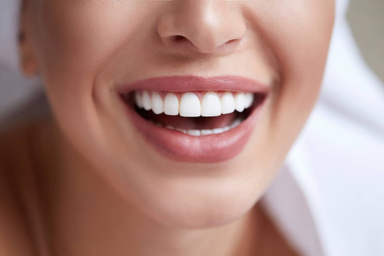 Meski Gigi Tampak Menarik, Ini 6 Dampak Buruk Dari Veneer Gigi