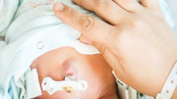 Moms Wajib Tahu, Ini 6 Cara Rawat Tali Pusat Bayi dengan Aman