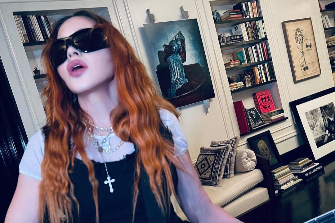 Sempat Alami Infeksi Serius, Madonna Bersyukur Masih Bisa Berjoget