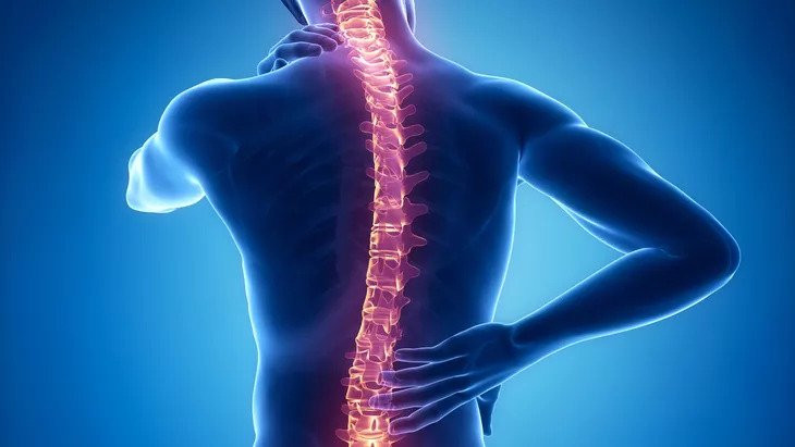 Perlu Diketahui! Skoliosis Ternyata Hanya Menimbulkan Rasa Pegal Bagi Pengidapnya