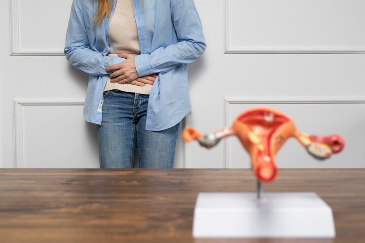 Perempuan Wajib Tahu! Ini Tanda Gejala Dan Faktor Risiko Endometriosis