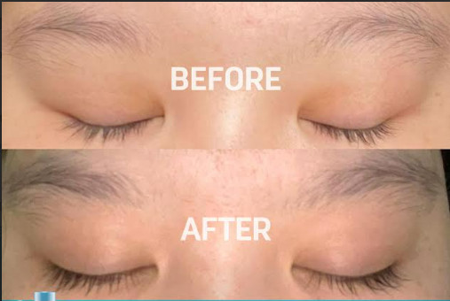 Erhair Lashbooster, Multi-Peptide Lash & Brow Serum Optimal Tumbuhkan Bulu Mata dan Alis