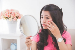 Sering Jengkel Karena Acne Prone Skin? Ini Solusinya!