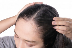 5 Kesalahan Perawatan Rambut yang Sering Dilakukan Pemilik Rambut Tipis, Hindari!