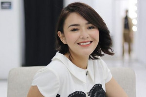 Jatuh dari Tangga, Amanda Manopo Alami Dislokasi hingga Absen Syuting 