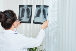 Vaksin Pneumonia Penting Bagi Anak dan Orang Dewasa, Ini Alasannya