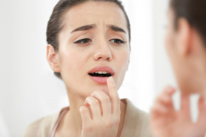 Selain Kurang Nutrisi, Ini 6 Faktor Penyebab Munculnya Sariawan di Bibir