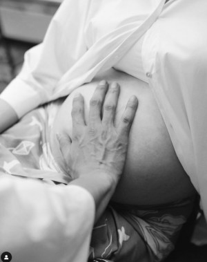 Alami PCOS? Ini Dia 5 Cara Agar Cepat Hamil