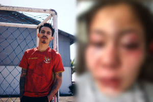 Viral di Media Sosial, Perempuan Asal Bandung Jadi Korban Kekerasan Suaminya