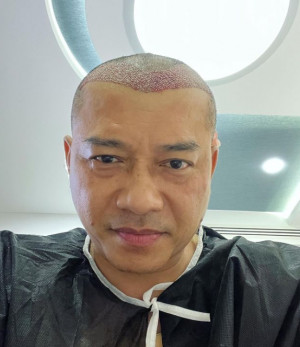 Anang Hermansyah Tampil Botak, Warganet Sebut Mirip Raul Lemos