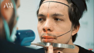 Disebut Mirip Aktor Cilik Korsel, 6 Potret Atta Halilintar Usai Transplantasi Rambut