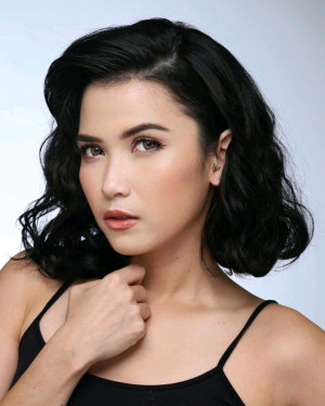 Alami Kecelakaan, Ini 5 Fakta Dinda Kanya Dewi