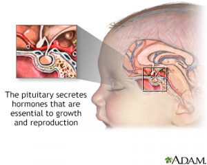 Mengenal Empty Sella Syndrome, Penyakit yang Menyerang Tengkorak Kepala