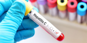 MSD Indonesia Tegaskan Pentingnya Kesadaran akan Hepatitis di Indonesia