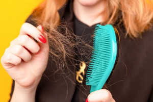 Wajib Tahu! 5 Cara Mudah Atasi Masalah Rambut Rontok