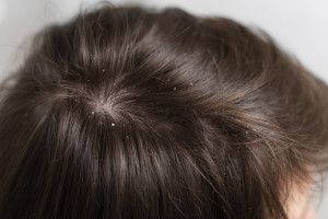 Kerastase SYMBIOSE, Era Baru Perawatan Anti Ketombe