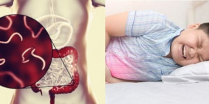 Wajib Dicoba! 5 Bahan Alami untuk Basmi Cacingan pada Anak