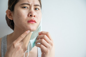 Cara Mencegah Skindemik, Masalah Kulit Akibat Penggunaan Masker