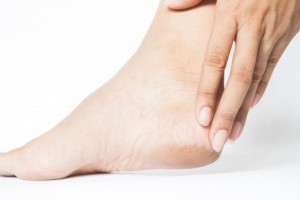 Tumit Kaki Pecah-pecah? Atasi dengan 6 Cara Ini, Yuk!