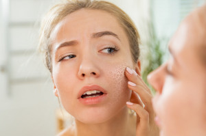 6 Bahan Skincare yang Cocok untuk Kulit Kering