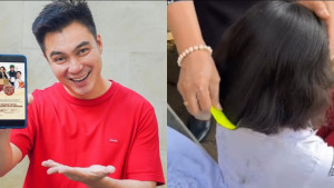 Wah! Baim Wong ke Solo, Temui Bocah Viral yang Penuh Kutu