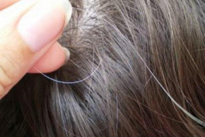 5 Penyebab Munculnya Uban di Usia Muda yang Perlu Kamu Ketahui
