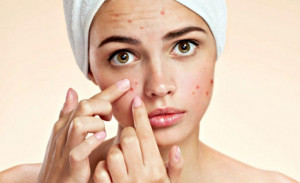 5 Efek Samping Negatif Skincare yang Harus Kamu Tahu