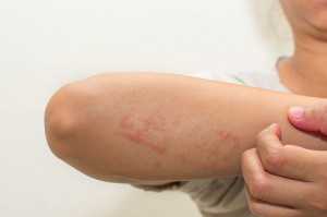 Bisa Picu Dermatitis, Yuk Cuci Pakaian Barumu!