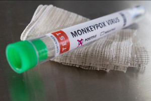 WHO Kembali Tetapkan Mpox sebagai Kegawatdaruratan Global, Kenali Gejalanya!