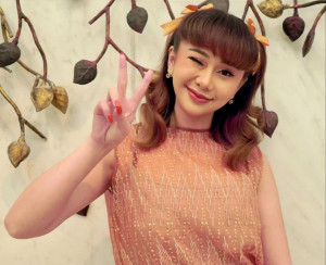 Namanya Trending Lagi, Denise Chariesta Bersyukur Bukan Soal Leher Berdaki