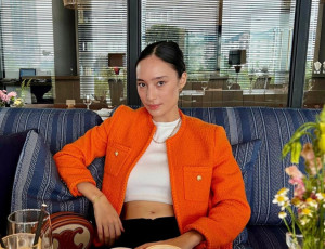 Berjuang Hadapi Jerawat, Tatjana Saphira Bagikan Foto Wajahnya Tanpa Riasan
