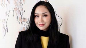 Fakta Seputar Operasi Anti-Aging yang Dijalani Titi DJ