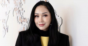 5 Prosedur Operasi Anti-Aging yang Dijalani Titi DJ di Korea Selatan