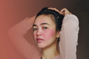 5 Kandungan Skincare yang Perlu Dihindari Penderita Rosacea