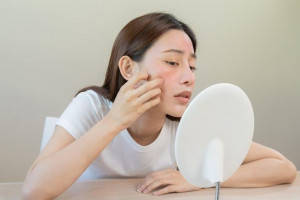 7 Kandungan Skincare Ini Sebaiknya Dihindari Bagi Penderita Eksim