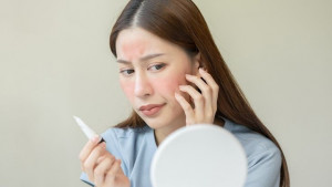 7 Kandungan Skincare yang Sebaiknya Dihindari Pemilik Kulit Iritasi