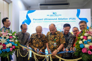 Lakukan Transformasi Kesehatan, RS Abdi Waluyo Hadirkan Focused Ultrasound Ablation