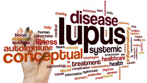 Mengenal Lupus Nefritis, Penyakit yang Diderita Sheila Malsiana Sebelum Meninggal