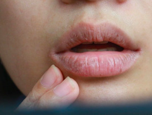 5 Tips Atasi Warna Bibir yang Gelap, Coba Yuk!