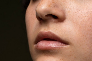 Waspada! Hal Ini Bisa Sebabkan Flek Hitam Pada Bibir