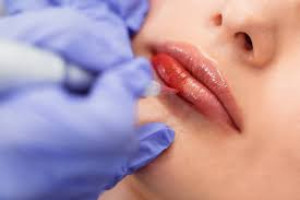 Ketahui Efek Samping dari Sulam Bibir, Treatment Kecantikan yang Jadi Tren