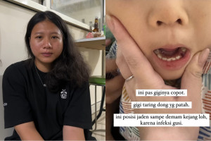 Terjadi Lagi, Baby Sitter Tega Aniaya Anak Hingga Badan Penuh Lebam