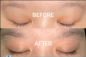 Erhair Lashbooster, Multi-Peptide Lash & Brow Serum Optimal Tumbuhkan Bulu Mata dan Alis