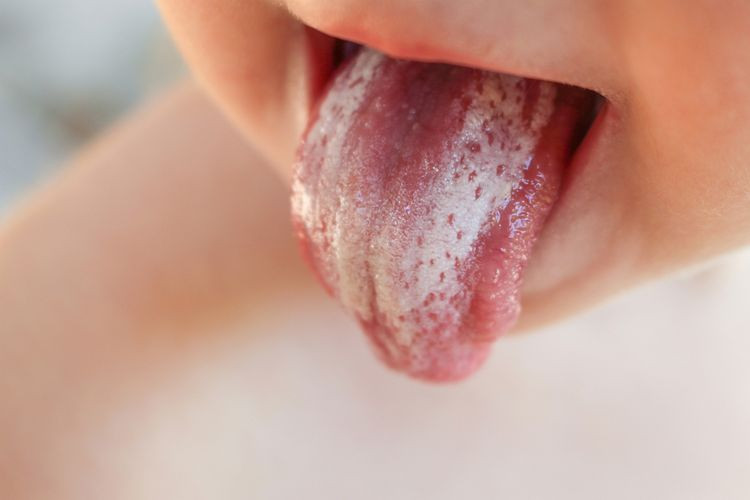 cara membersihkan lidah bayi