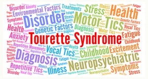 Kelainan Saraf Yang Dialami Billie Eilish dan Tora Sudiro